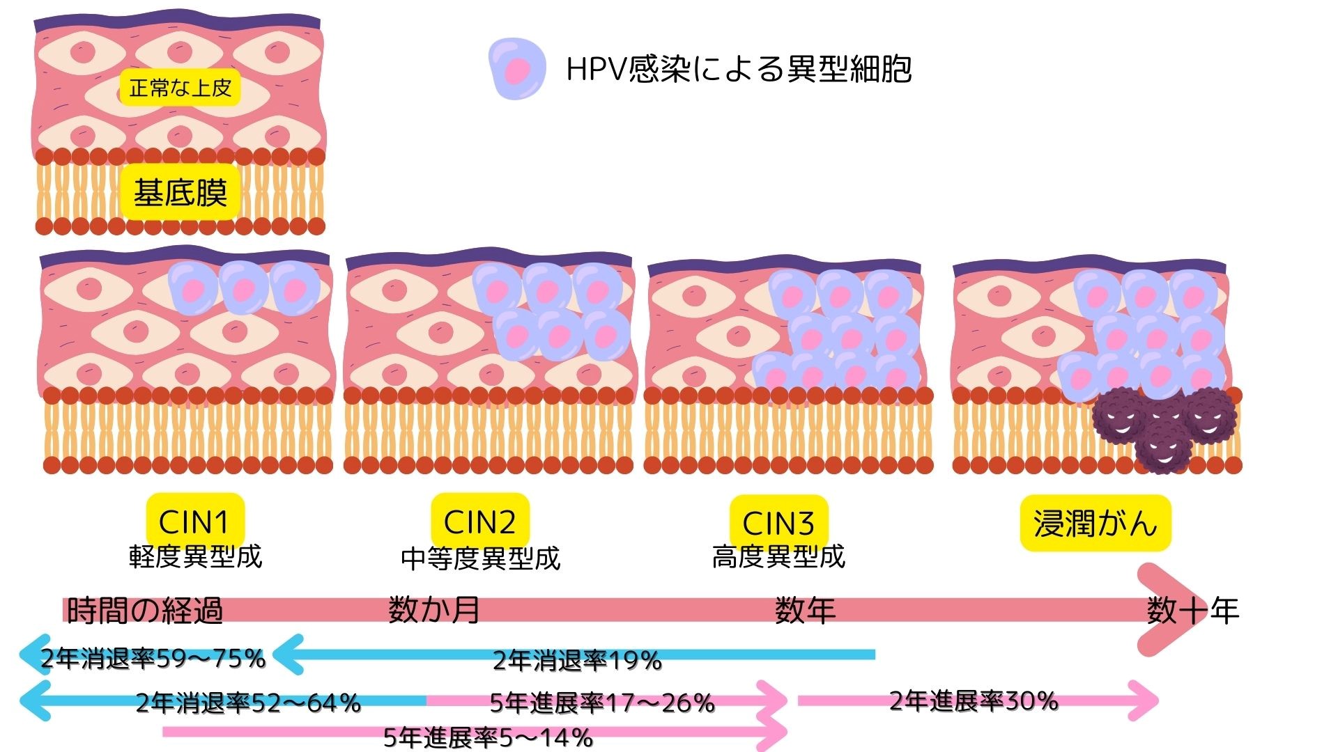 HPV感染による異型細胞